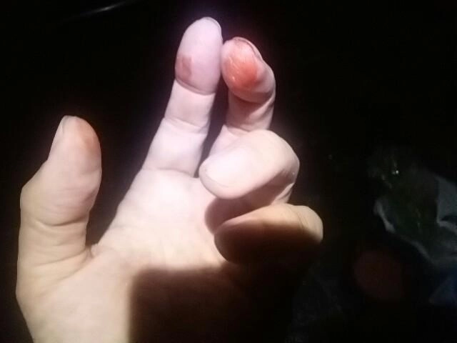 痛恨の一撃
